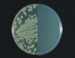 Acinetobacter baumannii